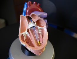 Graphic of heart model