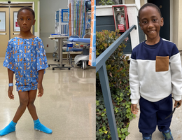 Two photos, first photo of a young boy standing in a hospital with knocked knees, second photo, same boy smiling at the camera with straight knees