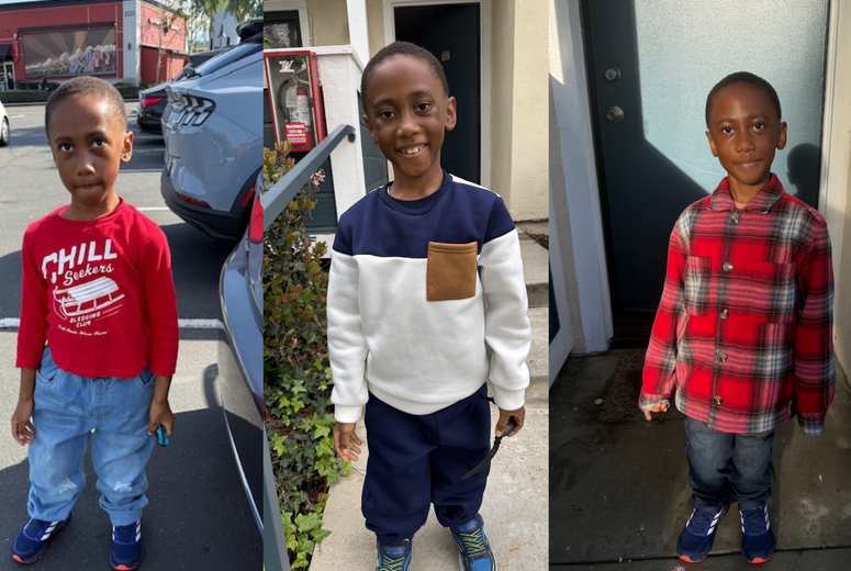 Ivan with straight legs after his surgery