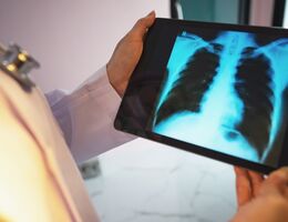 A doctor looking at an X-ray of the lungs