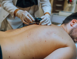 Dermatologist inspecting patient skin moles - stock photo
