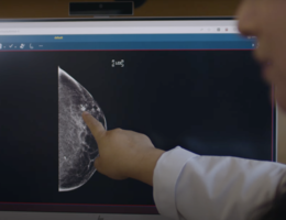 Hand pointing at breast scan