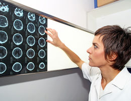 Woman doctor looking at brain scans