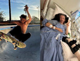One the left side, a skateboarder is in a skate bowl shirtless, on the right side, the same skateboarder lays in a hospital bed with a cast on his leg holding up the peace sign