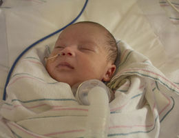 Newborn’s life saved by rare, specialized surgery at birth Jethro Quach at three weeks old in the NICU at LLU Children's Hospital