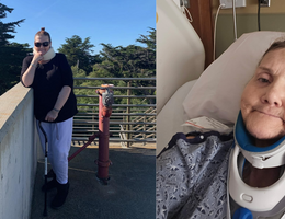 side by side photo of elizabeth, one standing with a cane outside wearing a neck brace, the other in the hospital wearing a neck brace