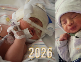 a newborn with medical equipment attached to their body is next to another newborn holding their arms up