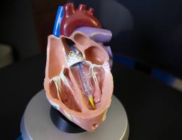 Alternative to open-heart surgery now available at Loma Linda University Medical Center - Murietta