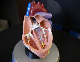 Alternative to open-heart surgery now available at Loma Linda University Medical Center- Murietta