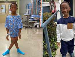 Two photos, first photo of a young boy standing in a hospital with knocked knees, second photo, same boy smiling at the camera with straight knees