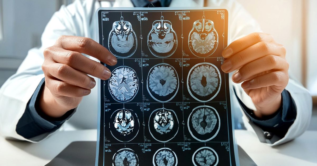 Memory lapse or something more? Neurologist addresses memory decline in aging Memory lapse or something more? Neurologist addresses memory decline in aging