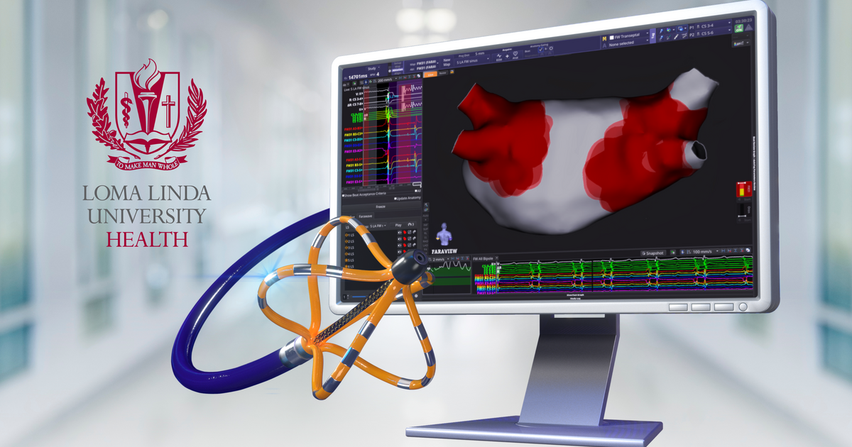 Expanding advanced heart rhythm care with updated technology | News